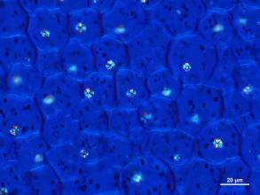 krystaly šťavelanu vápenatého v buňkách dělohy bukvice