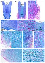 Somatic embryo of hybrid larch (line Q10) exposed to different desiccation treatments. Stained for phenolics, starch and storage proteins.