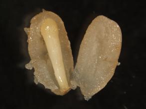zygotické embryo v semeni