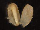  Norway spruce zygotic embryo